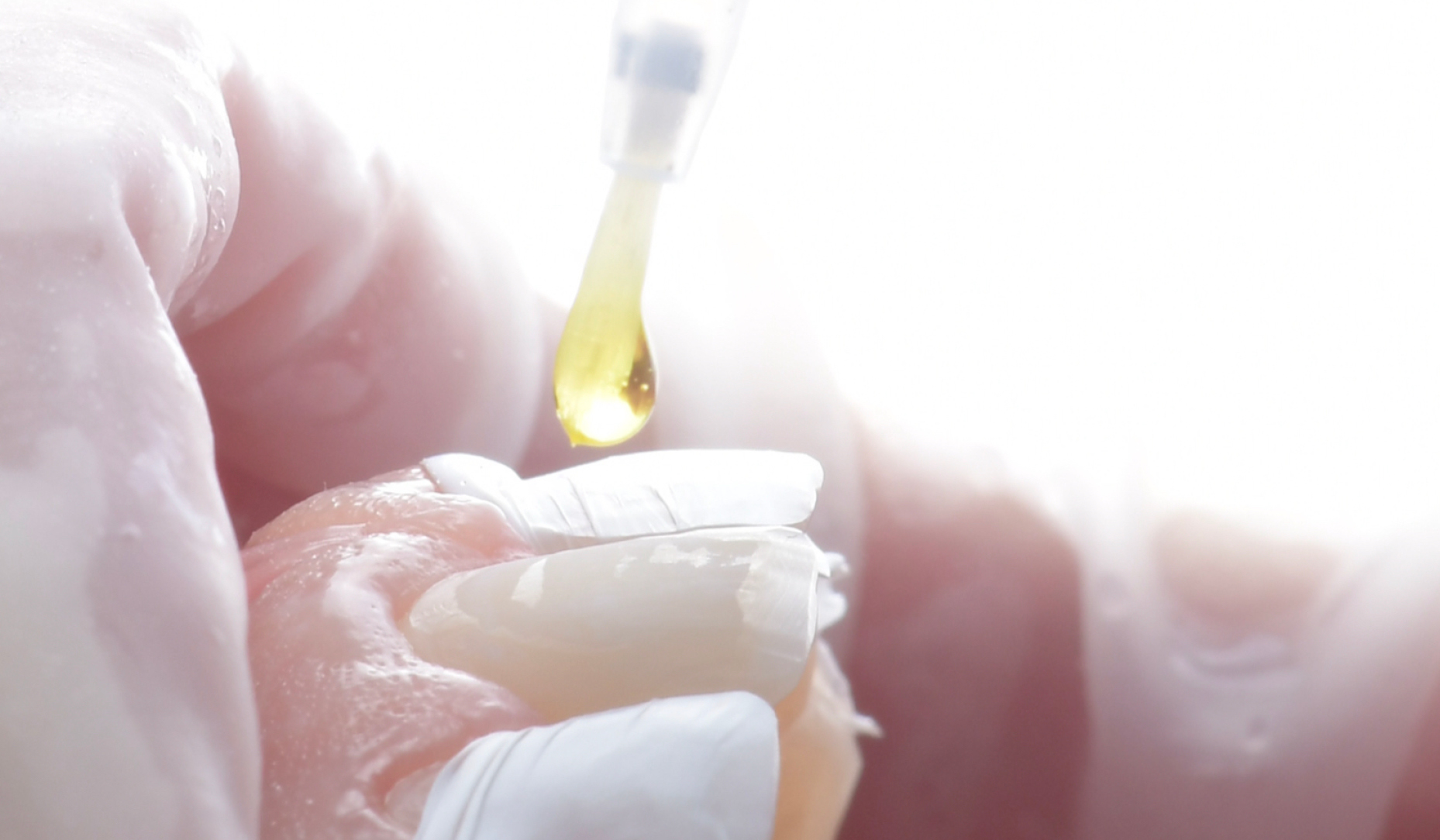 Figure 6a: Application of CLEARFIL™ Universal Bond Quick to the prepared surface.